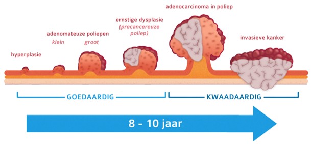 Ontstaan van dikkedarmkanker